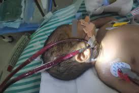 General - Canulacion Pediatrica